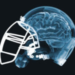 brain_injury_football